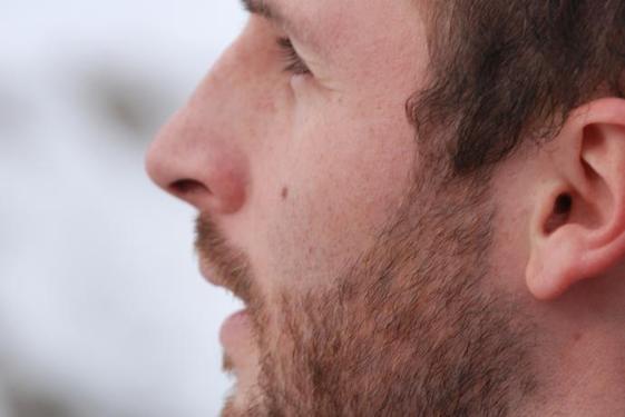 Click on the photo for the original